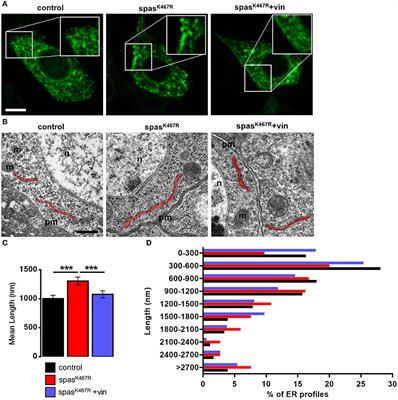 Microtubules Stabilization by Mutant Spastin Affects ER Morphology and Ca2+ Handling